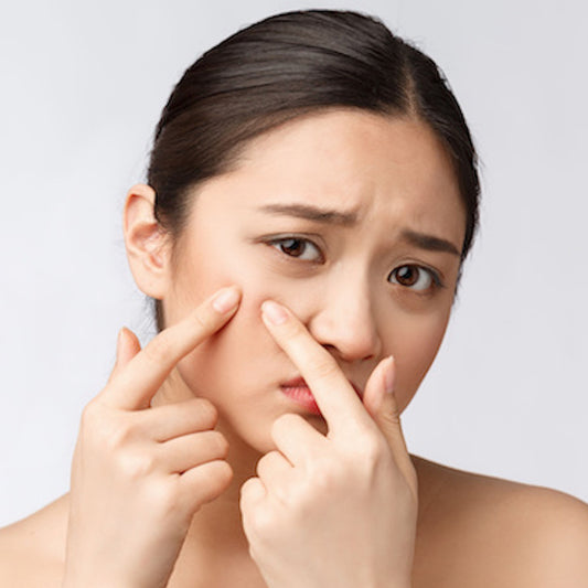 Modeller søkes til acne/ ungdom behandling
