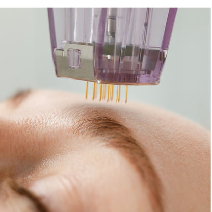 Workshop i Microneedling med Mesogold fra MCCM