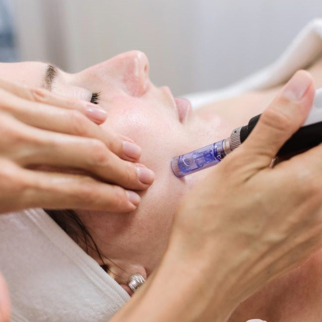 Kurs i Microneedling med Mesopen og Mesogold fra MCCM